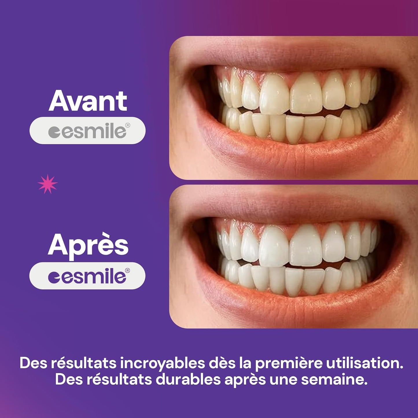 Bandes Blanchissantes Violettes – 21 Traitements | Éclaircissement Instantané Sans Peroxyde | Neutralise Le Jaune Et Illumine Le Sourire (42)